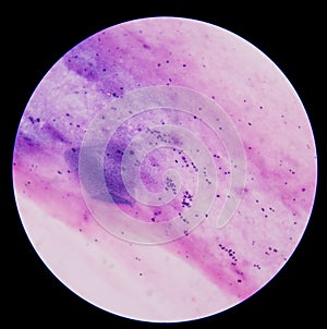 Gram positive cocci photo