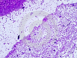 Coryneform Bacterium