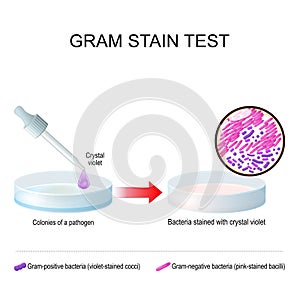 Gram stain test. A glass Petri dish with pathogen bacterial culture