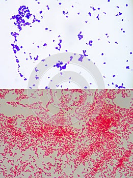 Gram staining