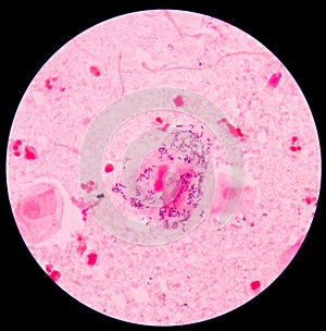 Gram staining, also called