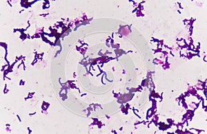 Gram staining, also called Gram`s method,.