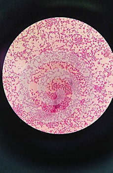 Gram staining , also called Gram's method, gram positive coccus