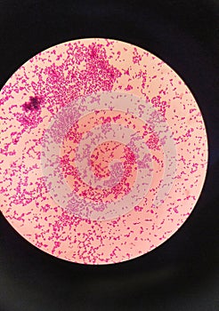 Gram staining , also called Gram's method, gram positive coccus