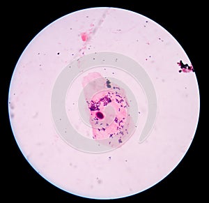 Gram staining, also called Gram's method, is a method of differe