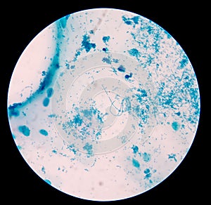 Gram staining, also called Gram's method, is a method of differe photo