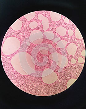 Gram staining , is a method of differentiating bacterial species. gram negative coccus