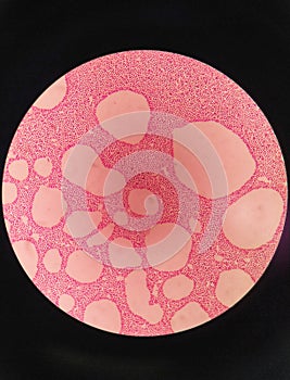 Gram staining , is a method of differentiating bacterial species. gram negative coccus