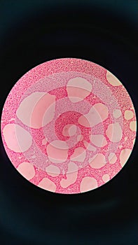Gram staining , is a method of differentiating bacterial species. gram negative coccus