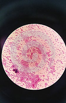 Gram staining, is a method of differentiating bacterial species into two large groups, gram positive coccus