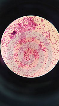 Gram staining , is a method of differentiating bacterial species. gram positive coccus