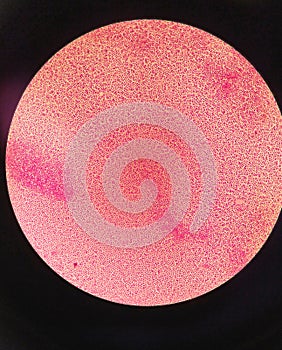 Gram staining , is a method of differentiating bacterial species. gram negative coccus