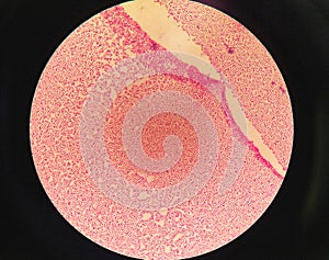 Gram staining , is a method of differentiating bacterial species. gram negative coccus