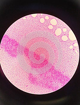 Gram staining , is a method of differentiating bacterial species. gram negative coccus