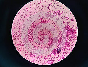 Gram staining , is a method of differentiating bacterial species. gram positive coccus