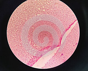 Gram staining , is a method of differentiating bacterial species. gram negative coccus