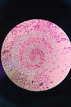 Gram staining ,gram positive coccus