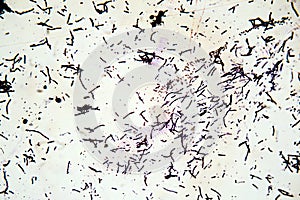 Gram staining of bacteria photo