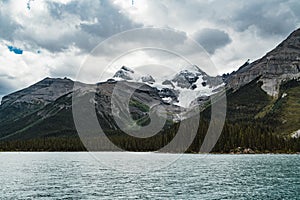 Grand Panorama of Surrounding Peaks at Maligne Lake, Jasper National Park.