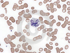 Histoplasma capsulatum in peripheral blood. photo