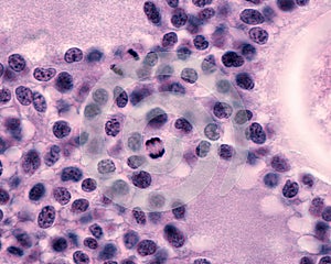 Granulosa cells. Mitosis photo