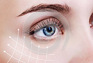 Graphic lines showing facial lifting effect on skin.