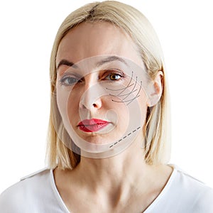 Graphic lines shows facial lifting effect on skin of beautiful woman.