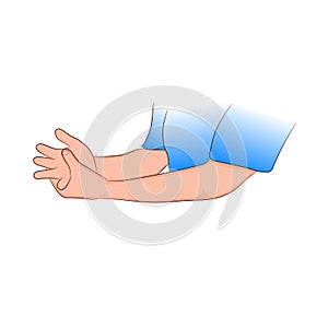 Graphics drawing concept Guillain-Barre syndrome Wrist pain is often caused or ascending para