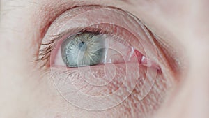 gray eye of middle-age caucasian male, brightly lit closeup