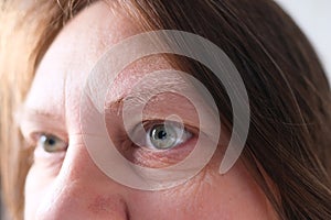 Gray eye with spots on iris, wrinkles on eyelids close up, human vision concept, optic nerve health, nervous tic, myopia,