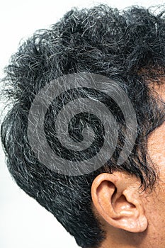 Gray hair side