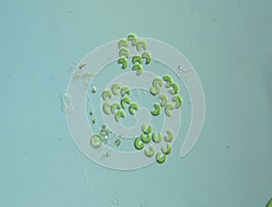 Green algae in drops of water