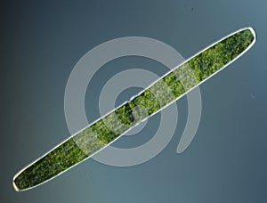 Green algae at high magnification