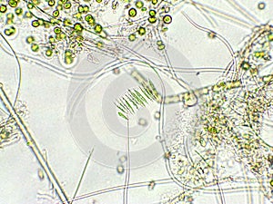 Green algae under microscopic view, Chlorophyta