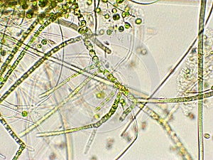 Green algae under microscopic view, Chlorophyta