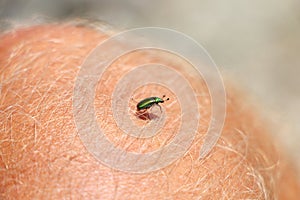 Green beetle insect on hairy skin