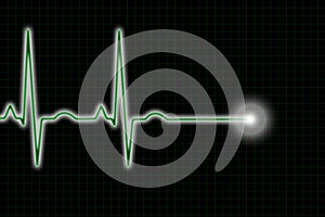 Green and Black ECG Trace