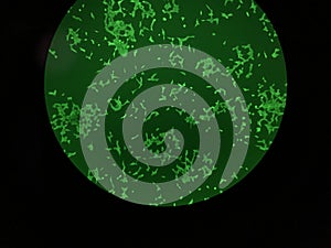 The Green fluorescence protein-expressing cell  through a cofocal microscope