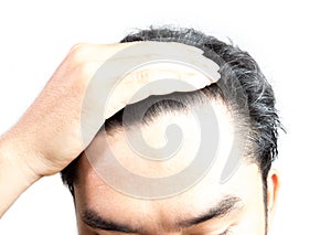 Grey hair on theyoung  man head. Hair Dye Product Concept