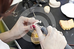 grinding and shaping a metal dental prosthesis