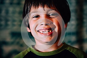 Grinning boy missing teeth