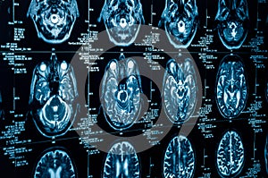 A group of CAT scans of the human brain