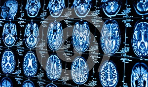 A group of CAT scans of the human brain