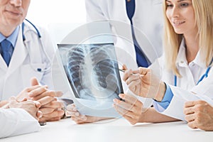 Group of doctors discuss x-ray