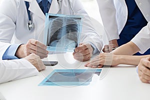 Group of doctors discuss x-ray