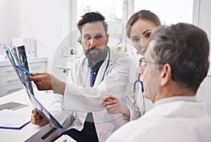 Group of doctors looking at the results of the radiology