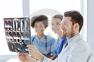 Group of happy doctors discussing x-ray image