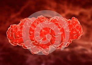 Grouping of blood cells forming a clot covered by a protein called fibrin