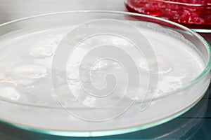 Growing Bacteria in Petri Dishes