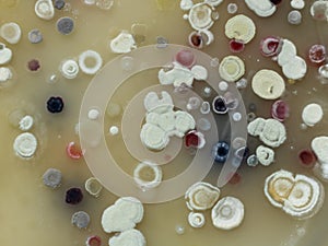 The growth of Actinobacteria cololonies on Cyganow and Å½ukov`s agar plates, with different colony texture and colors